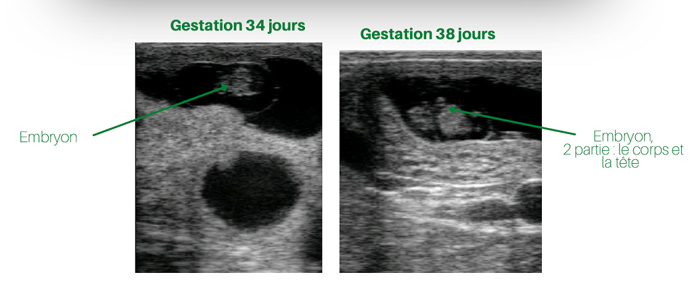 Echographie