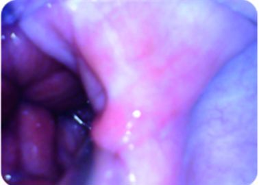 Membrane