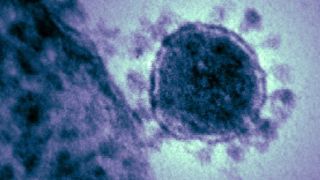 Trois questions pour les employeurs sur le coronavirus Trois questions pour les employeurs sur le coronavirus